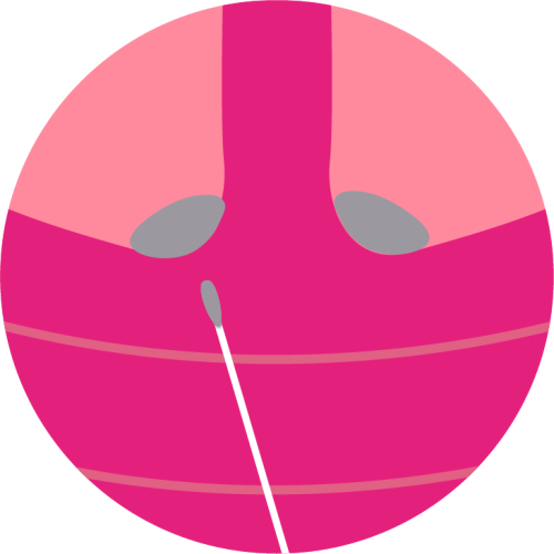 Betupfen des Gebärmutterhalses mit Essigsäure im Rahmen der Dysplasiesprechstunde Gyn Praxis Bonn